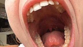 Yawning with a big wide mouth and big teeth! MP4