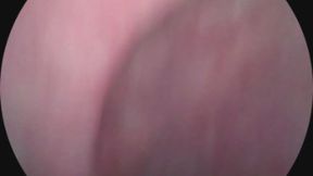 endoscope-mouth tour 2