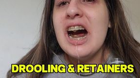 Drooling with my retainers on – spit and saliva all over as I drink