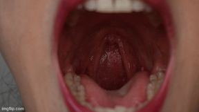 Yawning madness