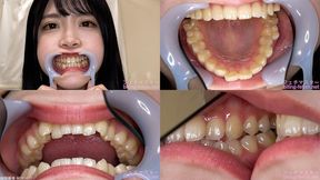 Akari - Watching Inside mouth of Japanese cute girl bite-265-1 - 1080p
