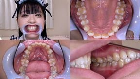 Anna Hanayagi - Watching Inside mouth of Japanese cute girl