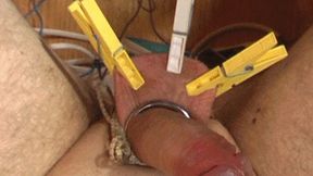 Electrical stimulation MP4