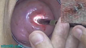 Doctor Gynecologist Inspects My Cervix, Womb, and Vagina&#x1F32E;&#xFE0F; with Endoscope