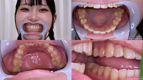 Mea Amemi - Watching Inside mouth of Japanese cute girl - MOV