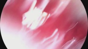 endoscope- teeth tour