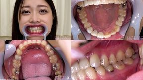 Mio - Watching Inside mouth of Japanese cute girl bite-278-1 - MOV 1080p