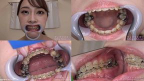 Koyoi - Watching Inside mouth of Japanese cute girl bite-153-1 - wmv