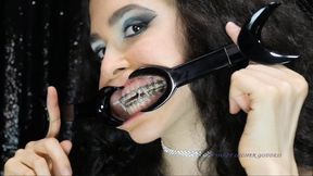 Rubber bands braces SD