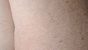 COUNT THE FRECKLES AND YOU SEE THE BLACK HAIR GROWING IN