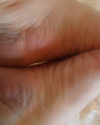 SOFT, RICH, SMELLY FEET photo