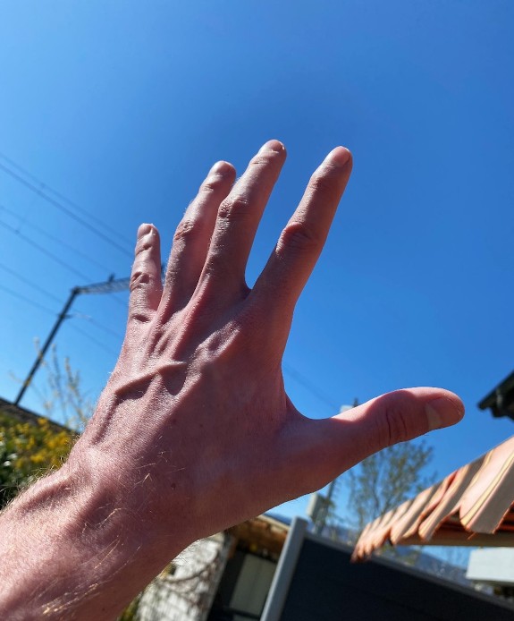 my hands