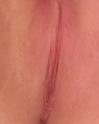 Pink Parts photo