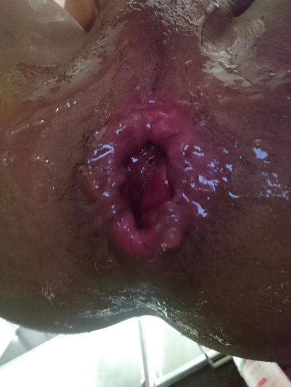 Wet anal