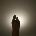 Missfeets