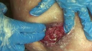 Prostate cumshot  (массаж простаты) Gape Prolapse