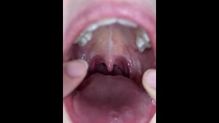 悬雍垂显示。口游