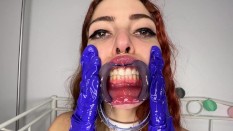 Spit