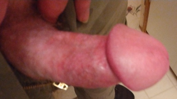 my dick