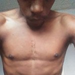 KingOCTX