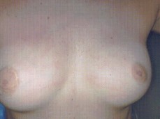 Beautiful Amateur Porn Suck Dick And Showing Boobs - Marthabullles 4K- Part 247 - Marthabullles gif