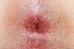 mic134gbp_384179170