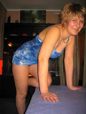 11 (320)
