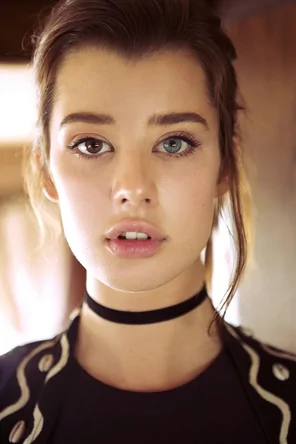 Heterochromia