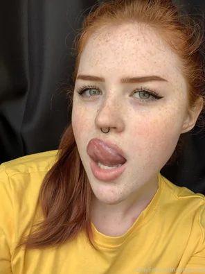 ginger-ed-10-04-2020-30898164-i have a rash on my body because i got int