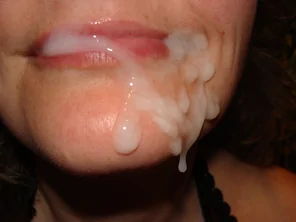Lip Face Cheek Skin Tooth Chin 