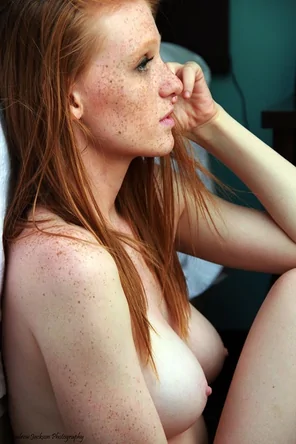 So many freckles!