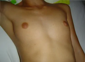 1 (96)