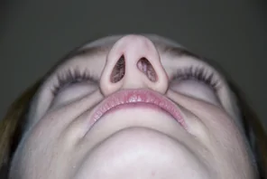 Before Nostrils
