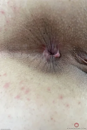 ros077atk_391880128