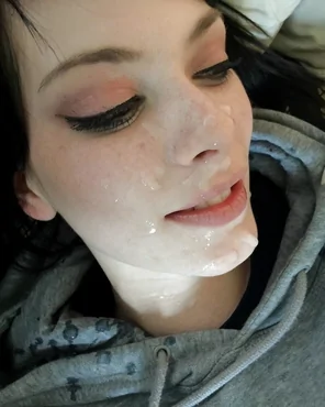 79