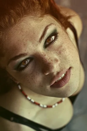 Freckles