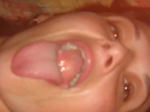 0000000094